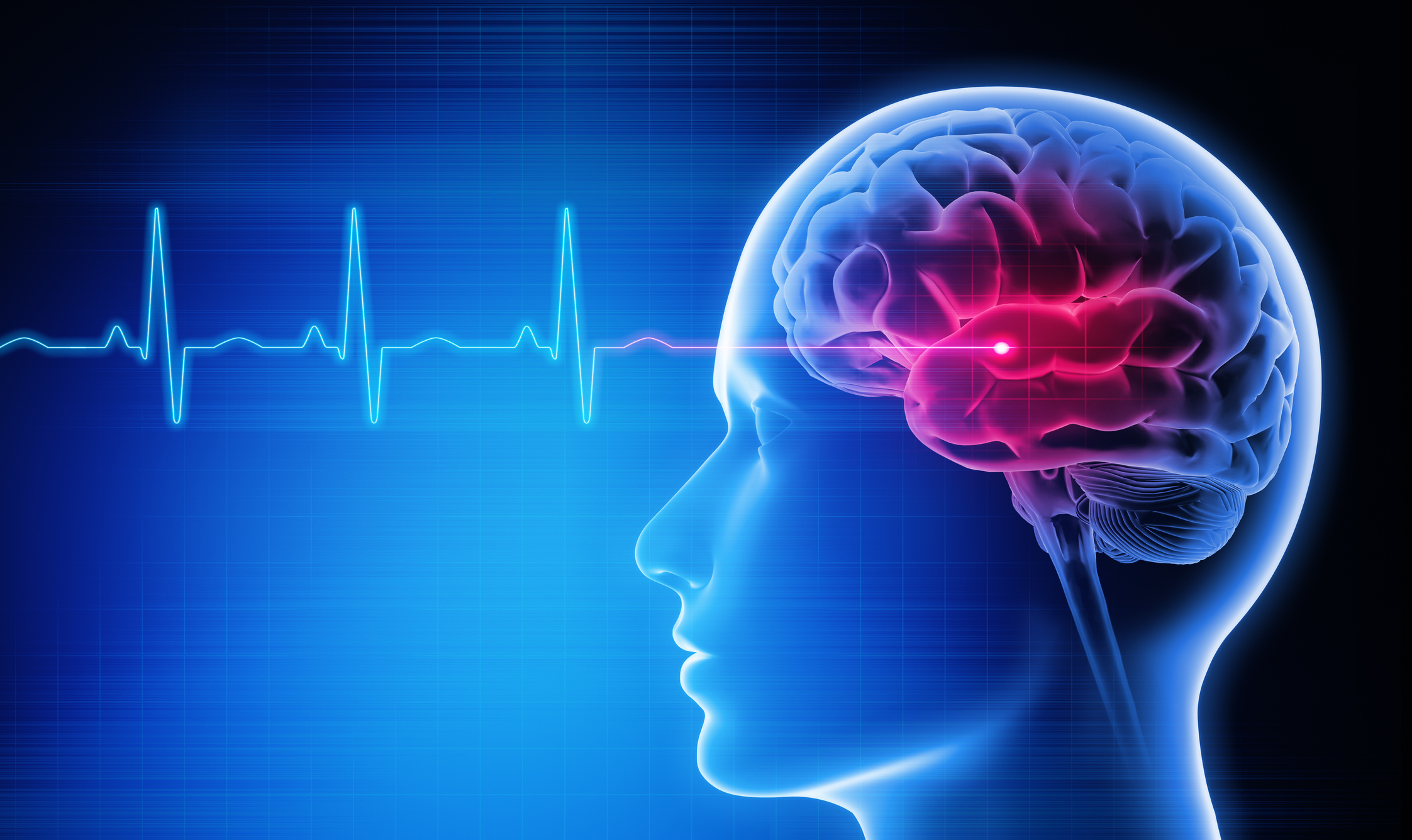 Neurosciences